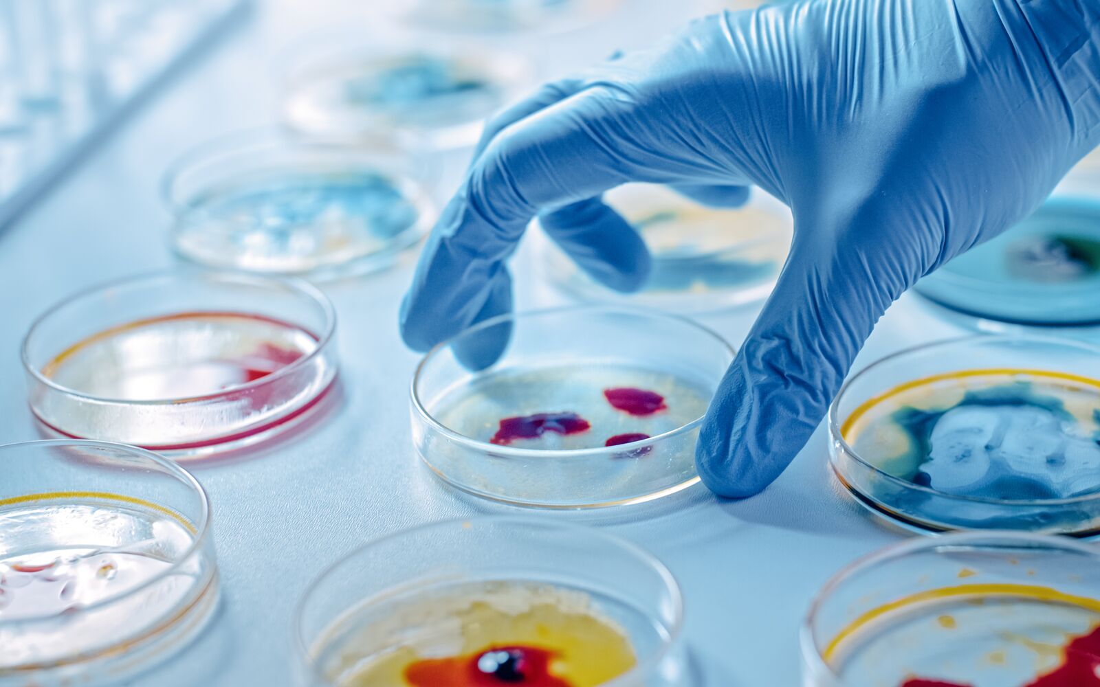 Career Options in Microbiology